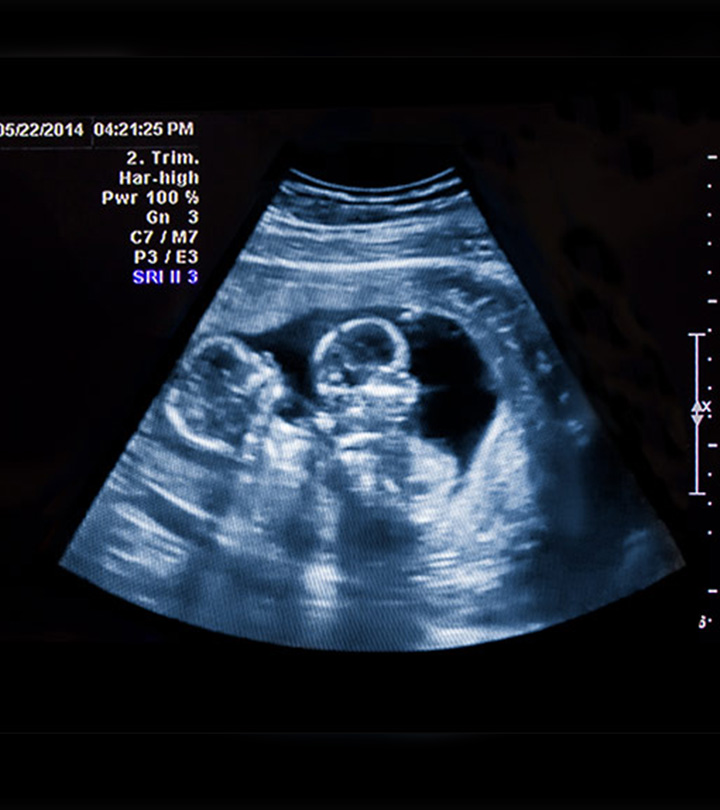 双胞胎在母亲子宫内接受超声波检查时“打架”的视频正在疯传
