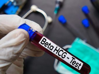 hCG血液妊娠试验程序，结果和准确性
