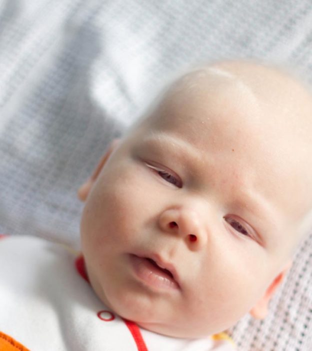 婴儿先天性眼球震颤:类型、症状和治疗
