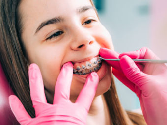儿童牙套类型，图片，正确的年龄和牙齿护理