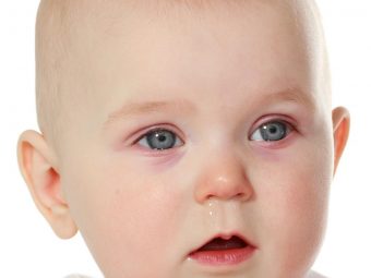 Pink-Eye-In-Babies-Causes,-Symptoms-And-Treatment