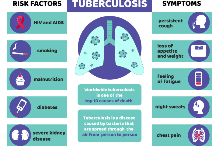 Symptoms Of Tuberculosis In Babies