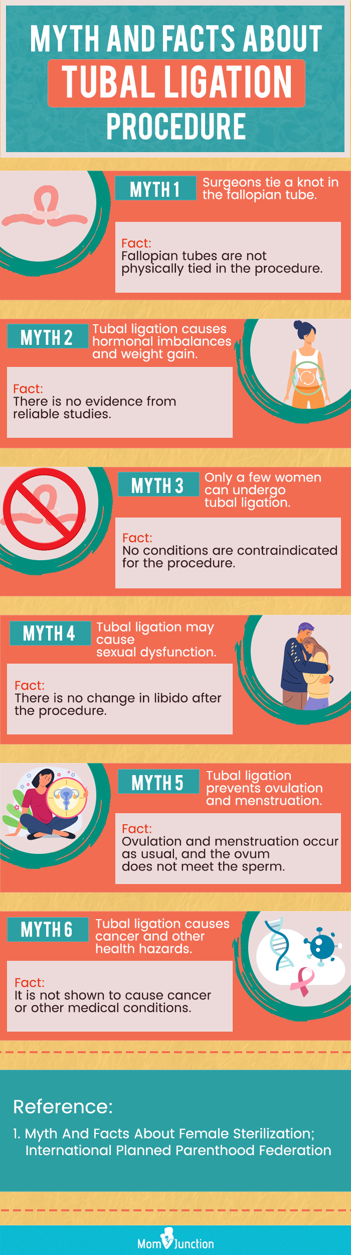 facts about tubal ligation procedure (infographic)