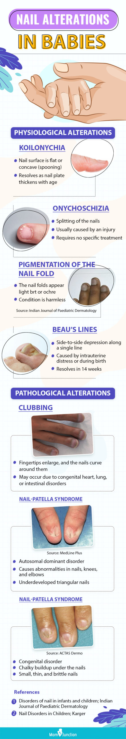 nail-alterations in babies (infographic)