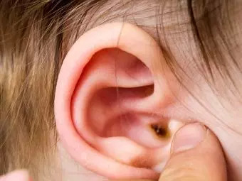 What-Causes-Earwax-In-Babies-And-How-To-Clean-It