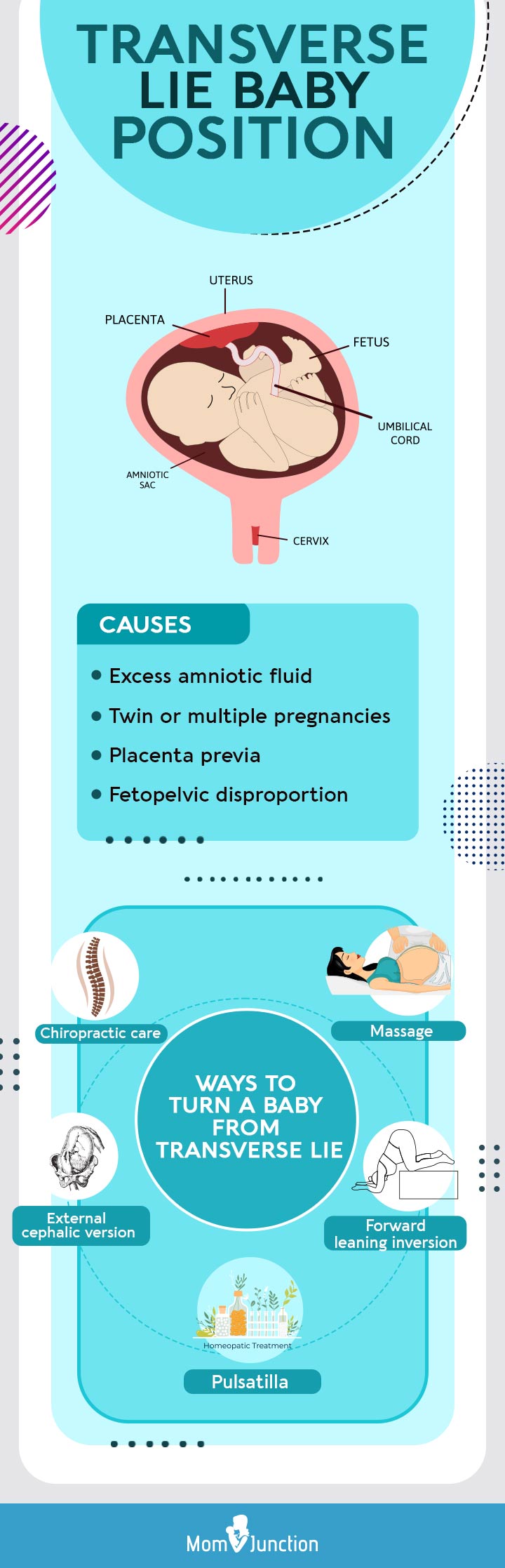 ways to turn a baby from transverse lie (Infographic)