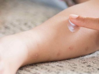 Calamine Lotion for Babies Uses, Safety And Side Effects