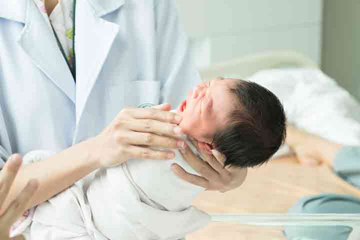 Doctor checks for the Moro reflex right after birth