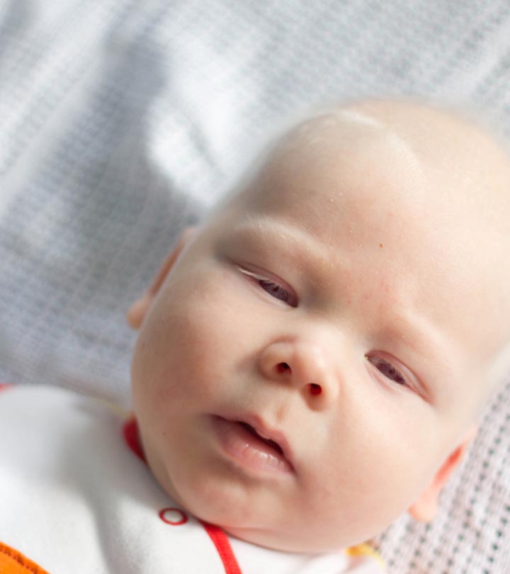 在婴儿先天性眼球震颤:类型,一个症状d Treatment
