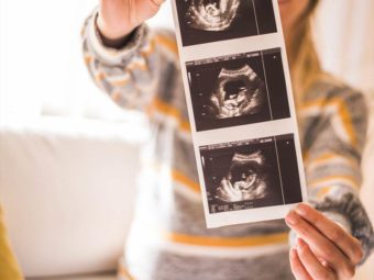 超声波在怀孕:类型、目的、过程And Preparation