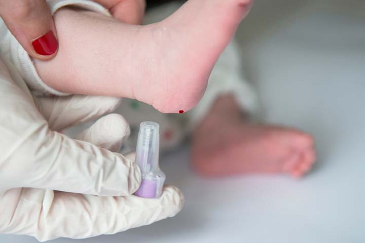 A blood test may help diagnose mononucleosis in babies