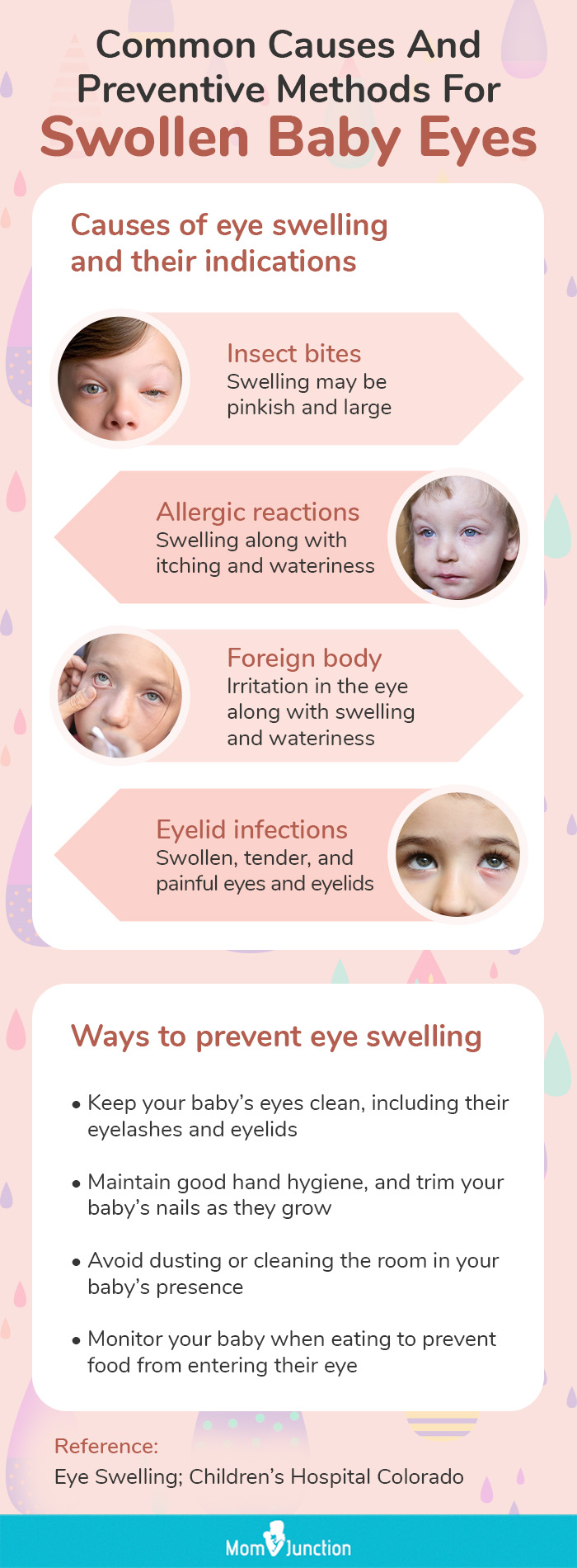 causes and preventive methods for swollen baby (infographic)