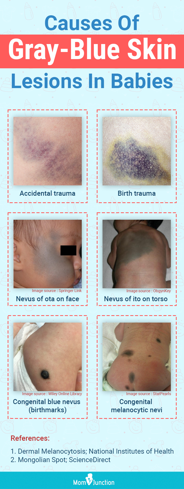 causes of gray blue skin lesions in babies (infographic)