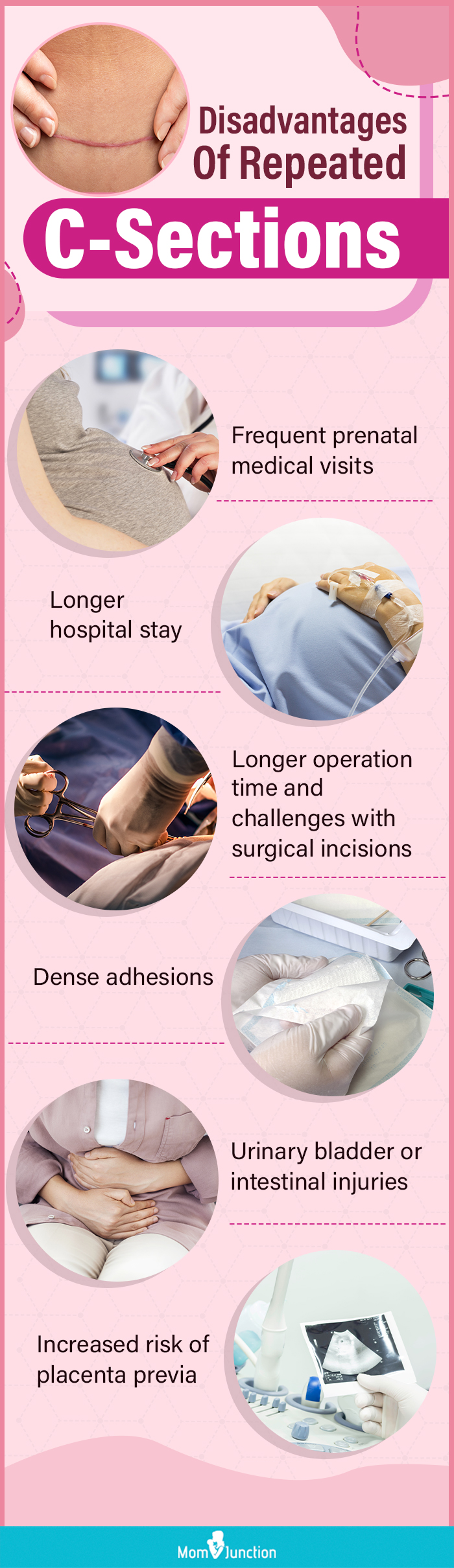 disadvantages of repeated c sections (infographic)