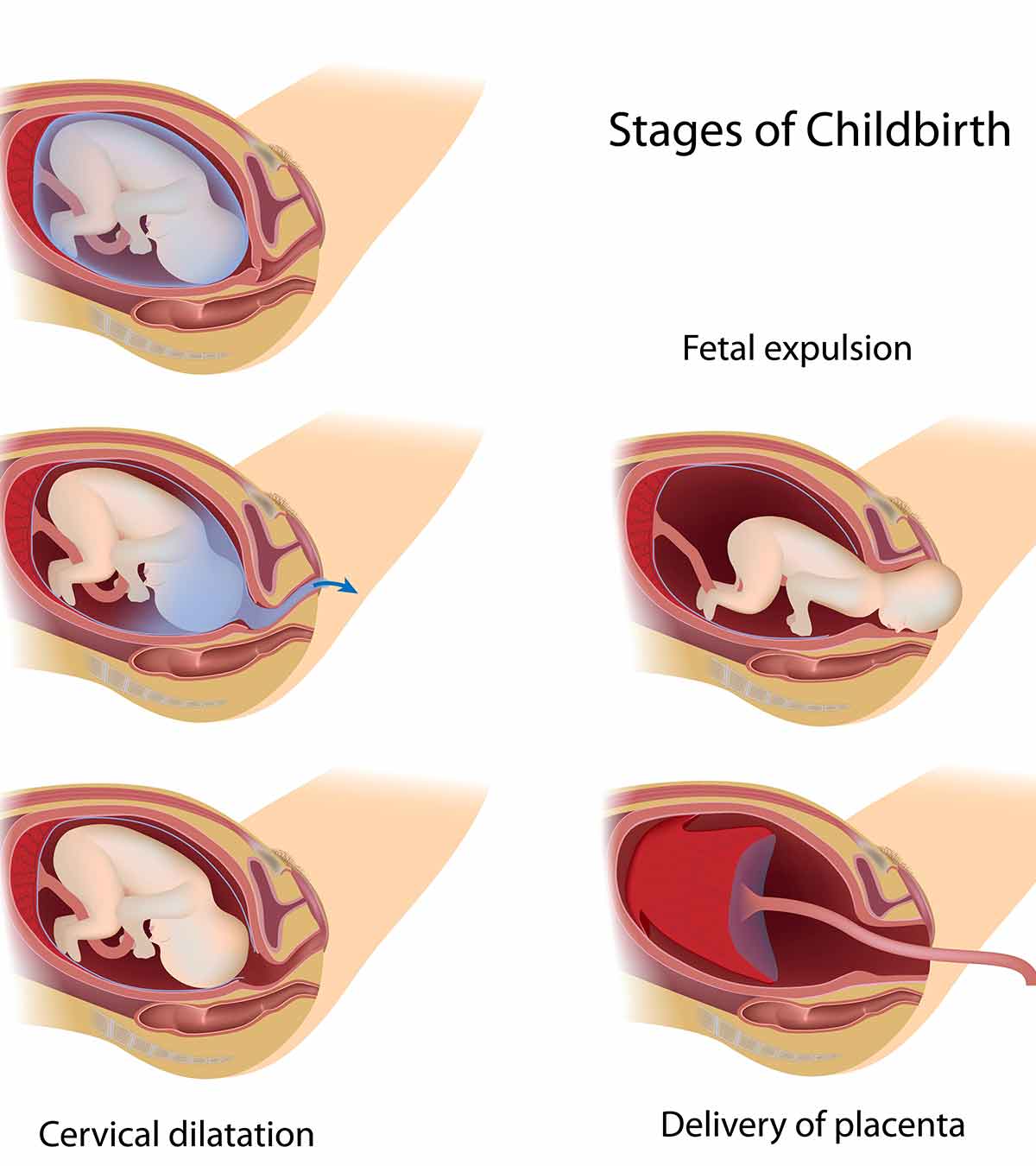 分娩的3个重要阶段:发生了什么，该怎么做