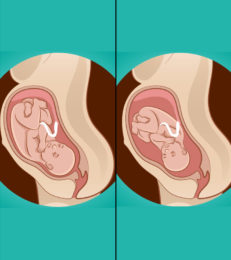最舒适的分娩体位是什么?