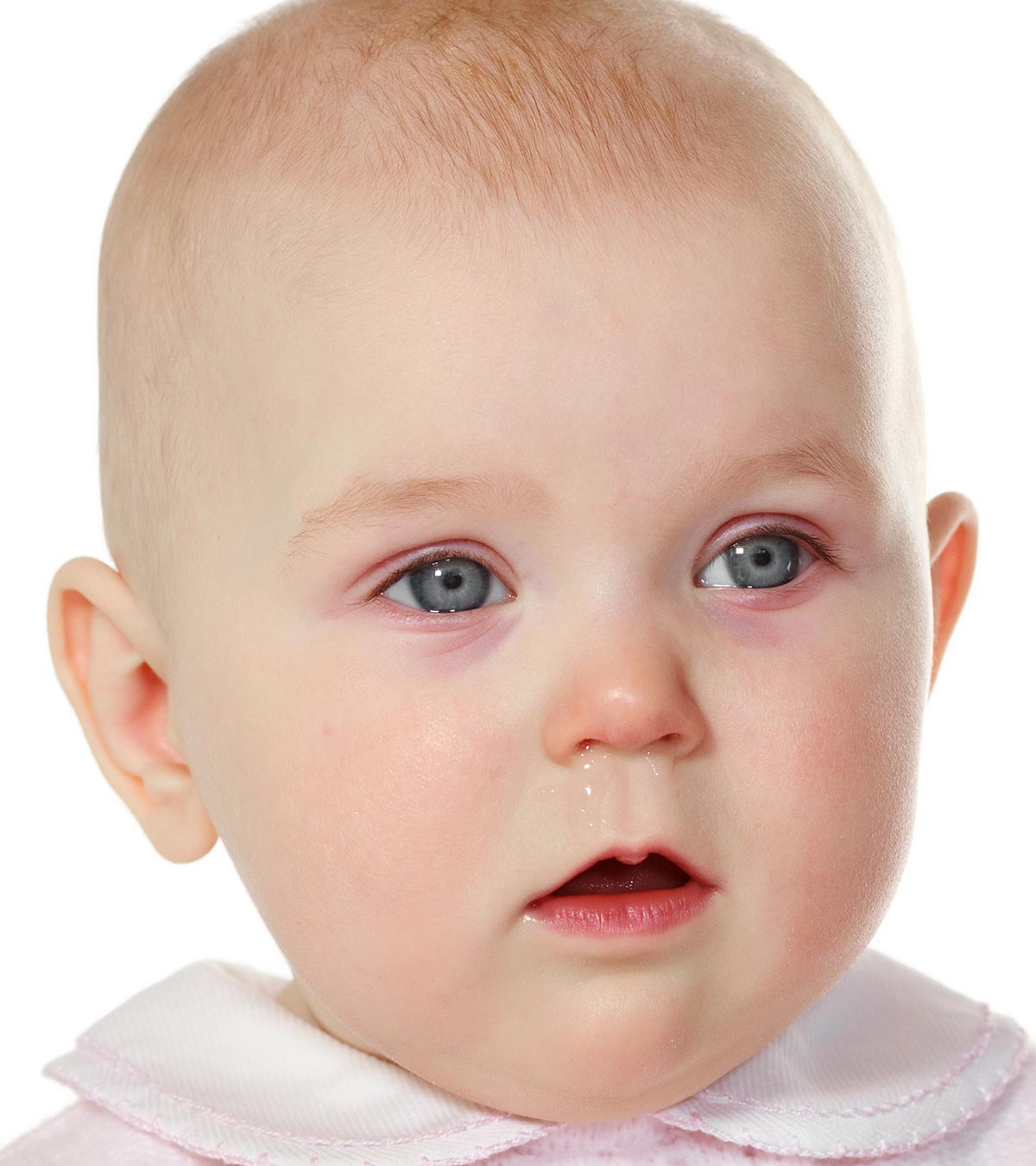 婴儿红眼:迹象，原因和治疗