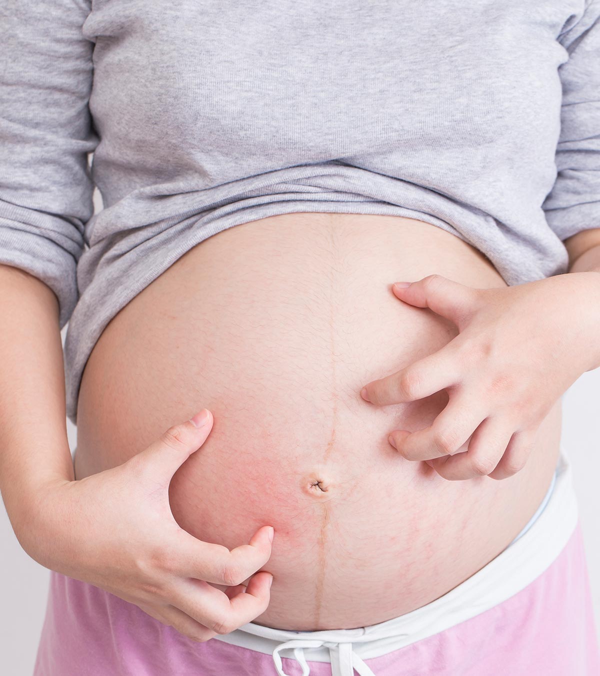 怀孕期间处理肚子痒的7个家庭疗法manbet安卓版