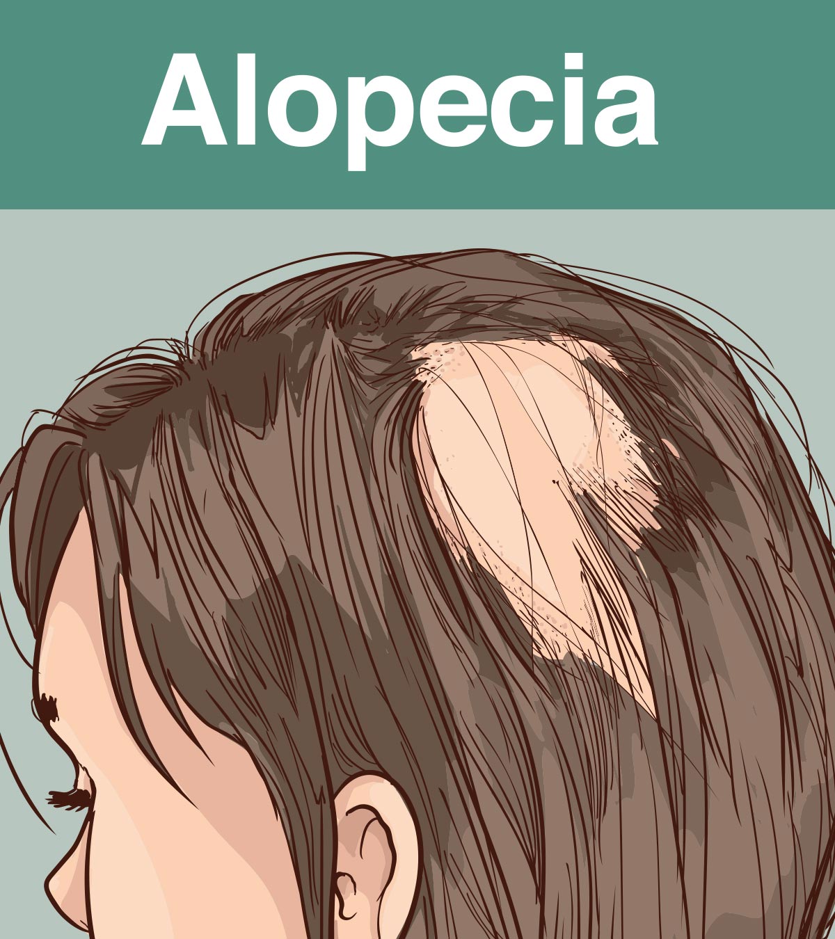 儿童脱发:类型、症状和治疗