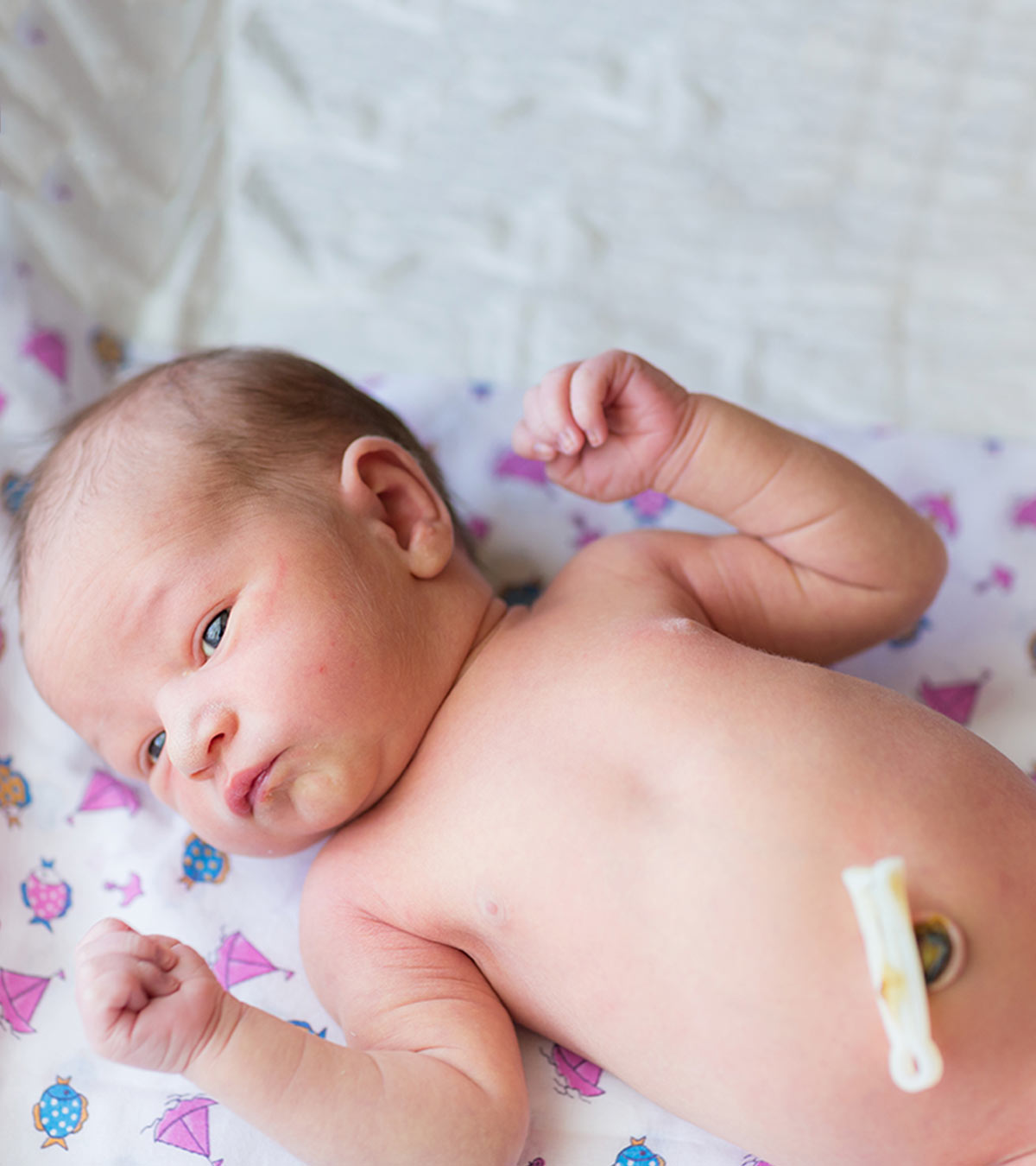 新生儿腹脐外露:原因、症状和治疗