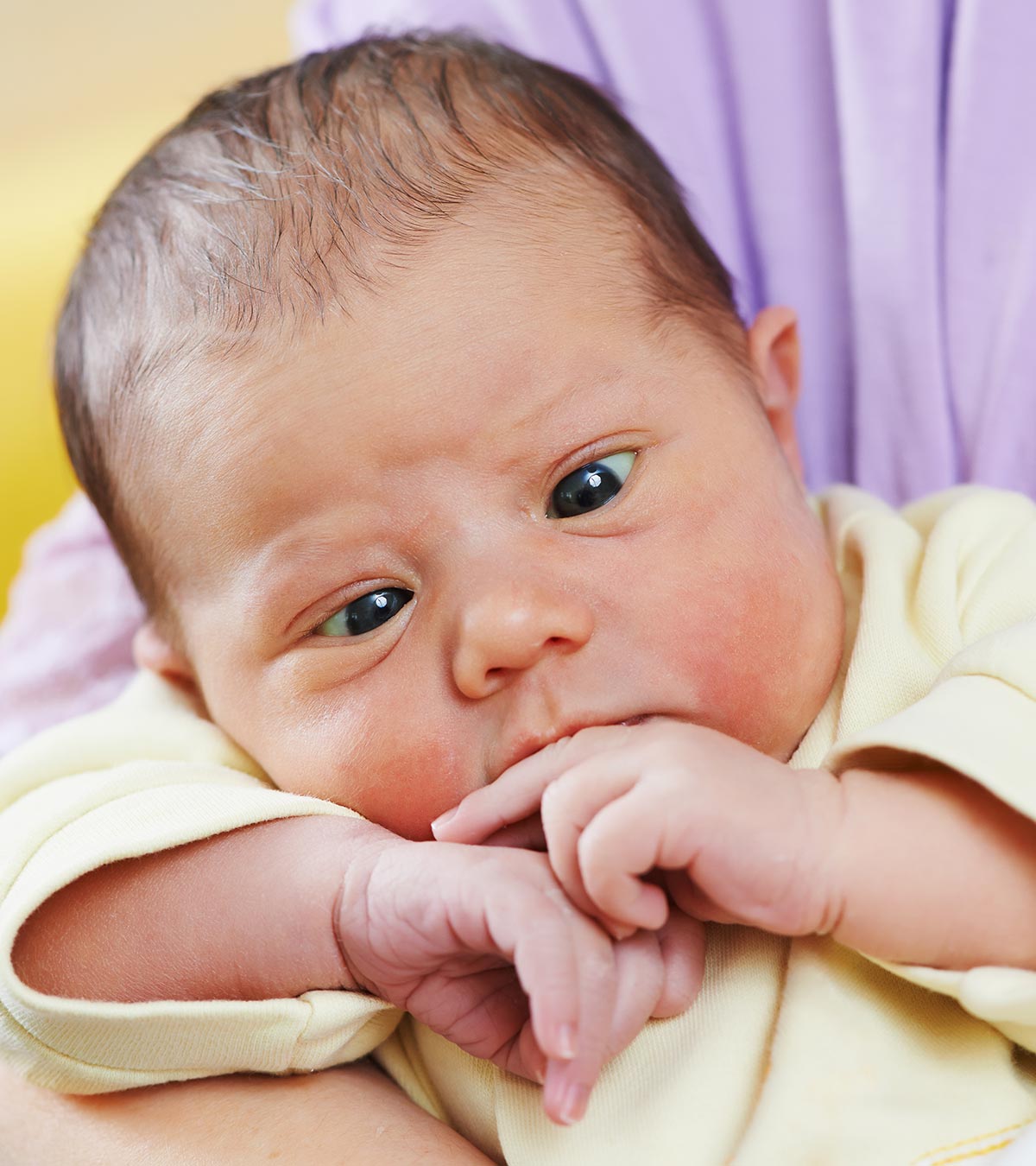 婴儿斜视(对眼)的症状、原因和治疗