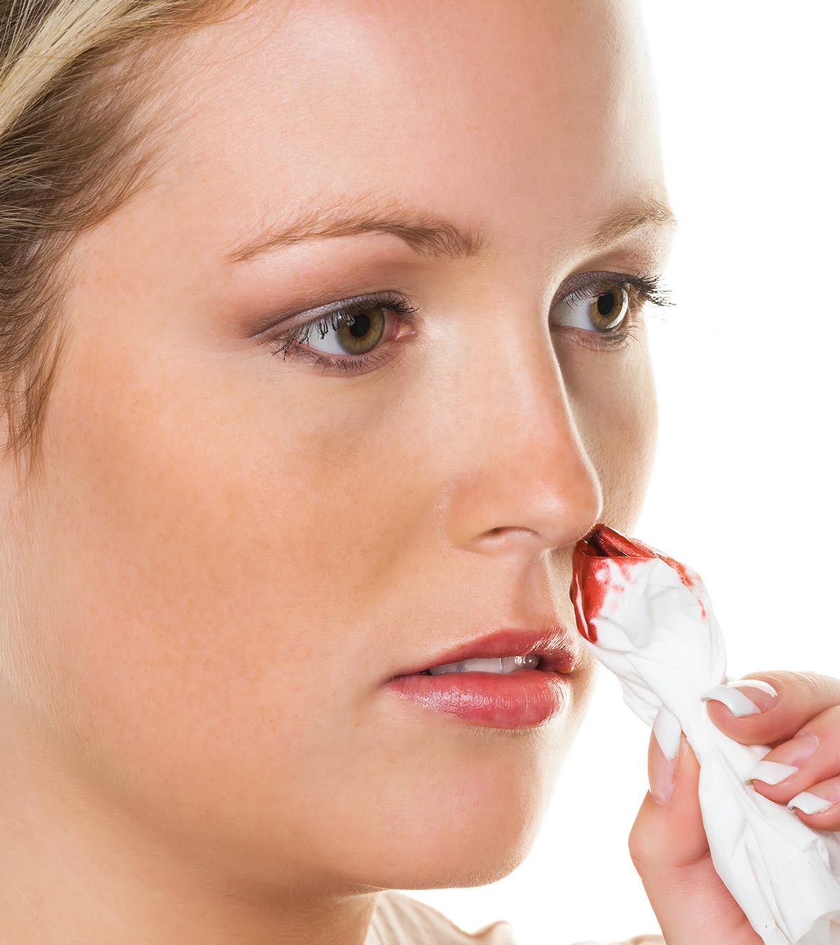 青少年流鼻血:原因、治疗和何时去看医生