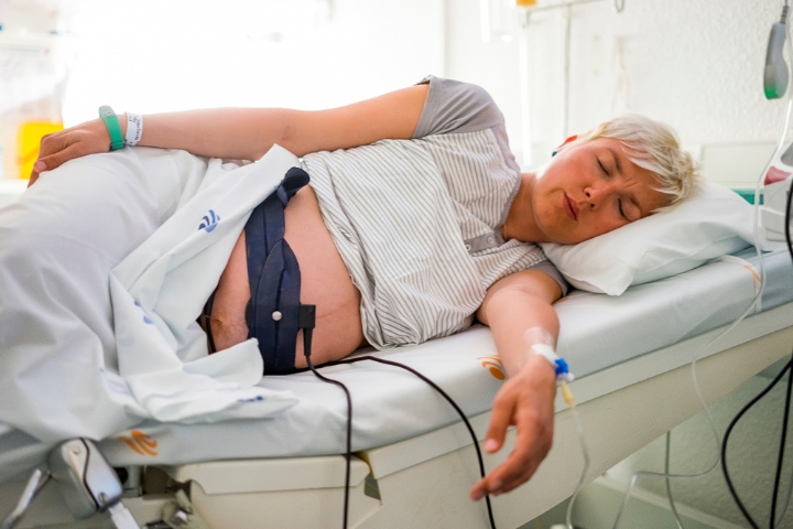 CST设备监测胎儿心跳