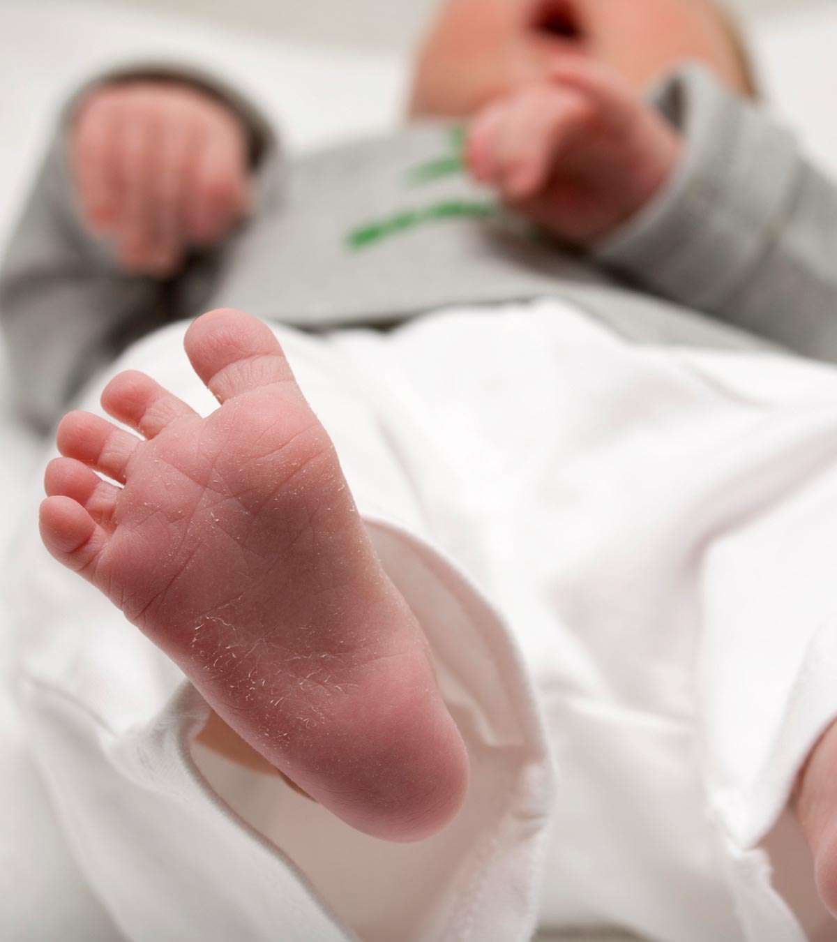 婴儿皮肤干燥的7个原因，症状和家庭补救措施