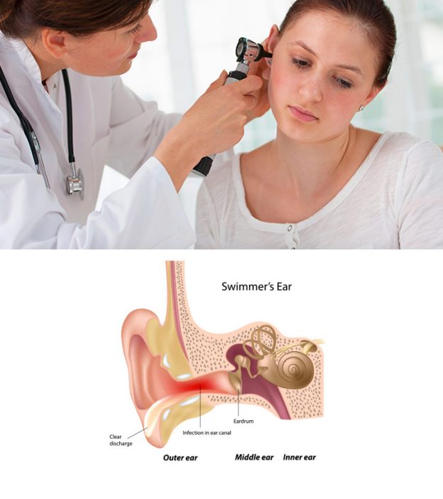 青少年耳部感染的10种症状，原因和治疗