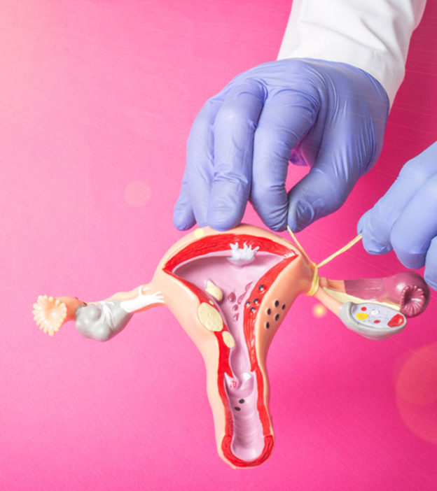 输卵管结扎后妊娠的症状及风险