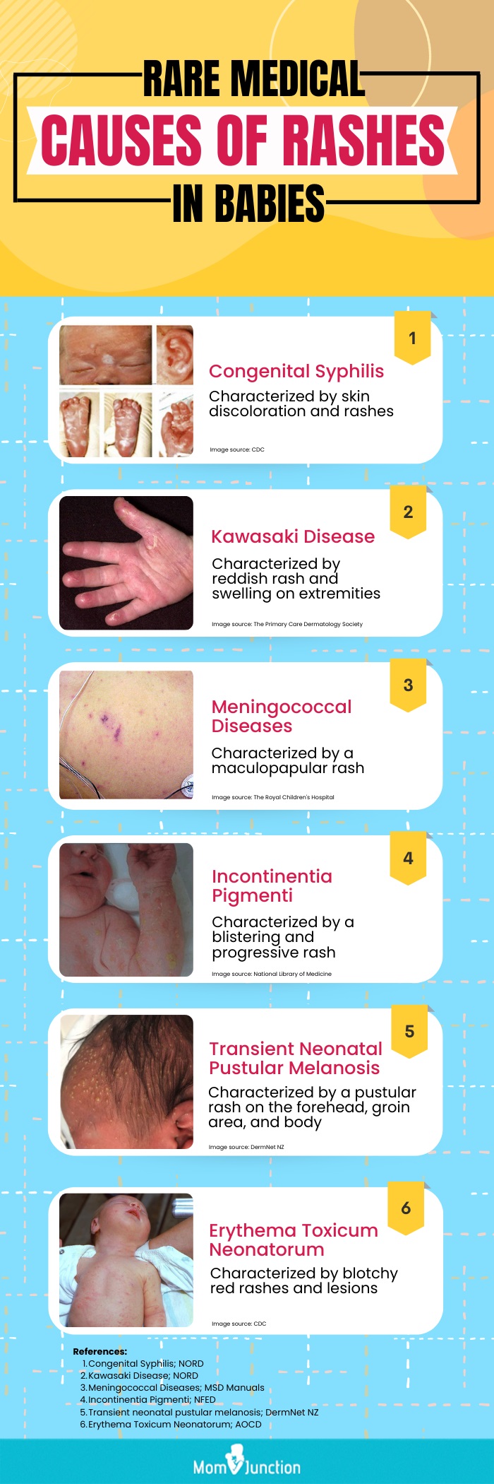 婴儿皮疹的罕见医学原因(信息图)