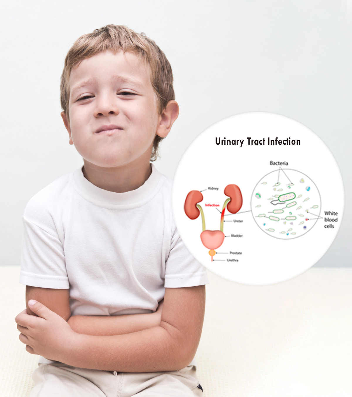 儿童尿路感染:原因、症状和家庭疗法