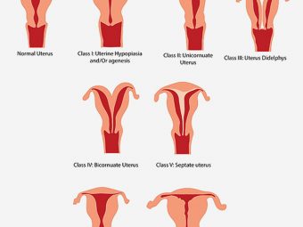 妊娠期间子宫异常-分类、症状及治疗manbet安卓版