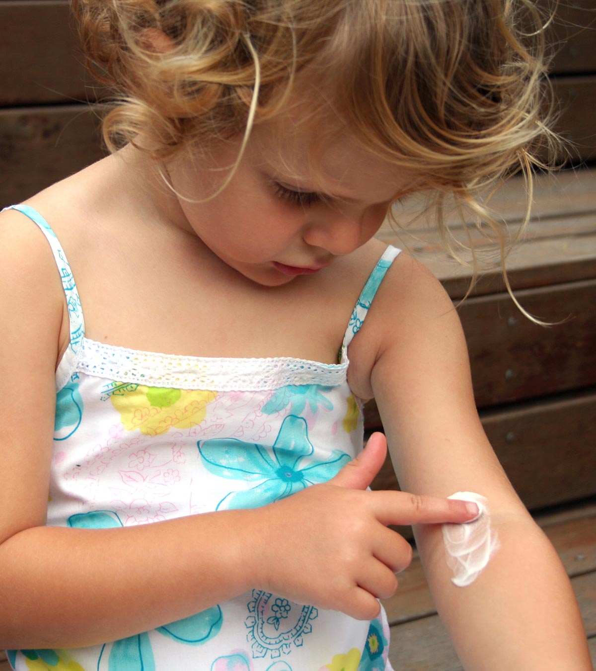 儿童湿疹:病因、症状和预防