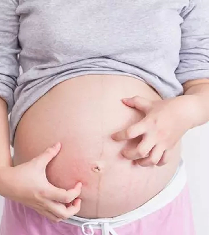 怀孕期间皮肤发痒可能对manbet安卓版宝宝有危险