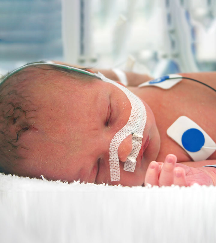 一个早产3.5个月的婴儿的视频:一个活着的奇迹