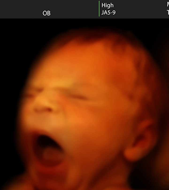 8件古怪的事情(除了宝宝!)你在超声波照片上看到的