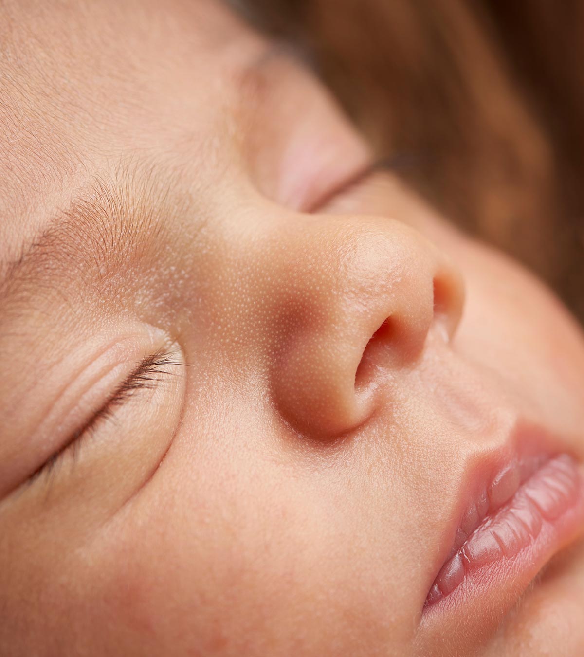 婴儿的唇裂:原因，家庭补救和预防