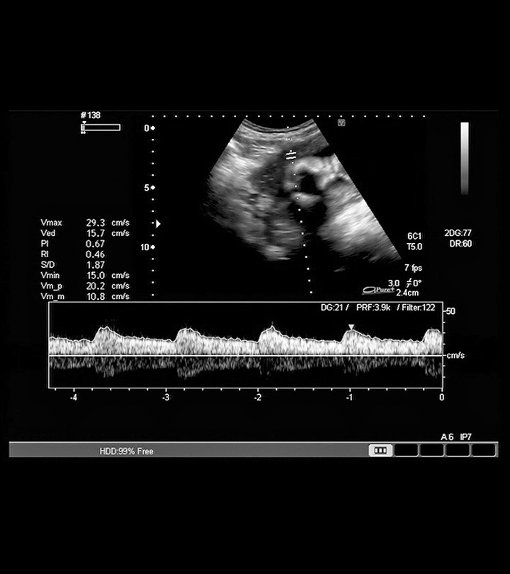 何时能听到胎儿心跳:一周一周的图表