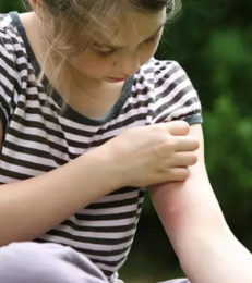 Tick Bites In Children: How To Deal With Them