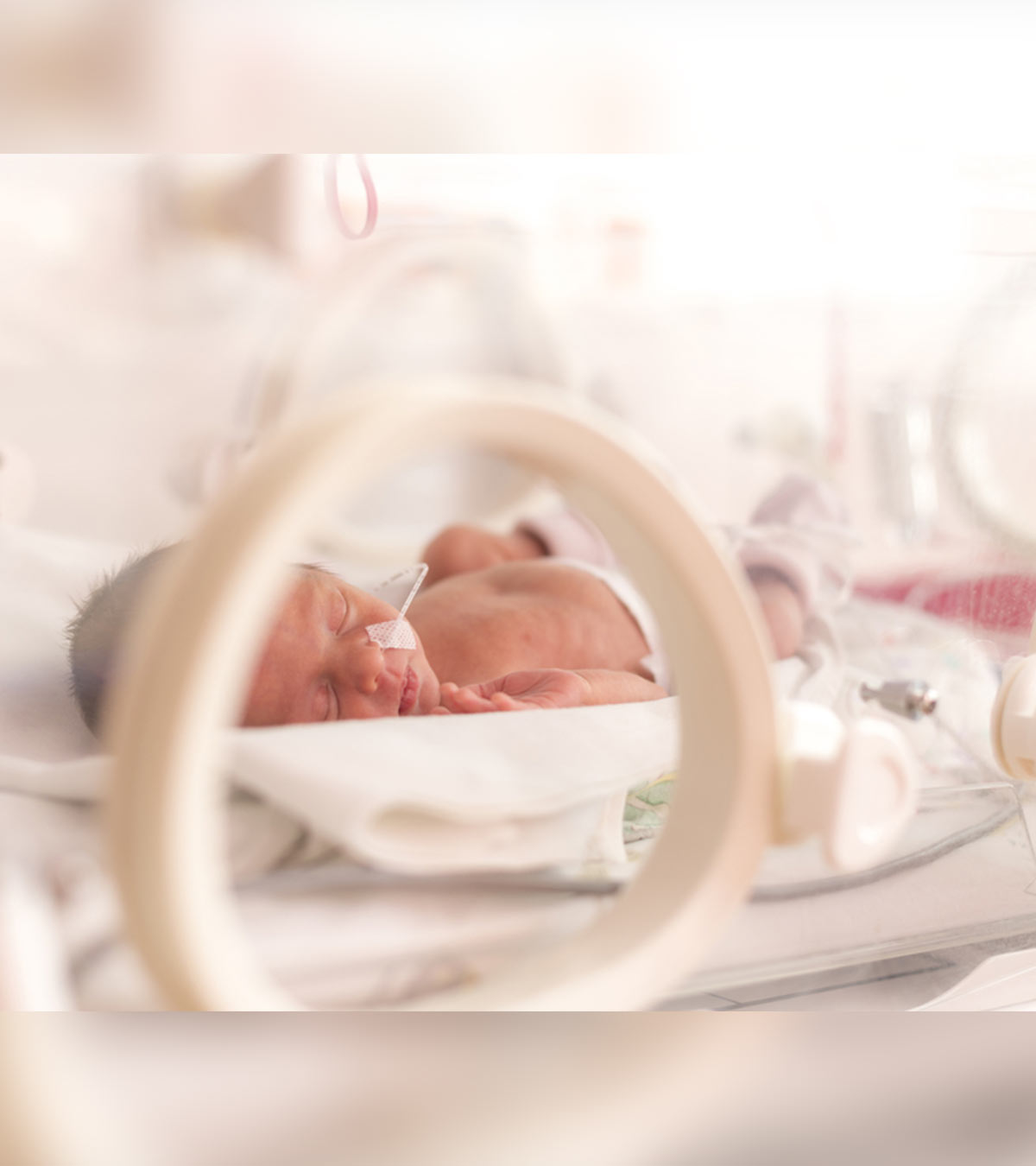 新生儿呼吸窘迫综合征:原因和治疗