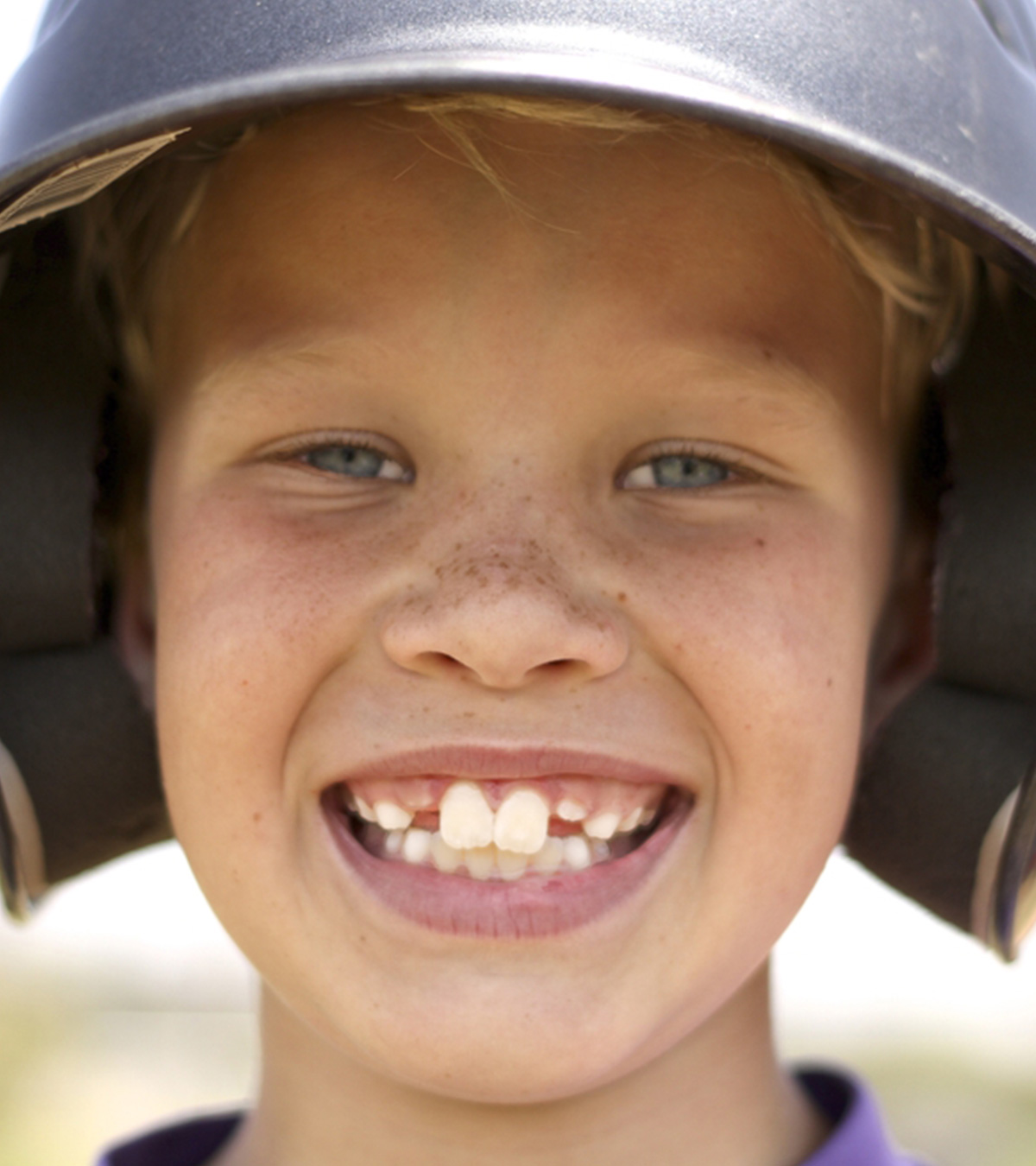 儿童龅牙的8个原因和可能的健康风险