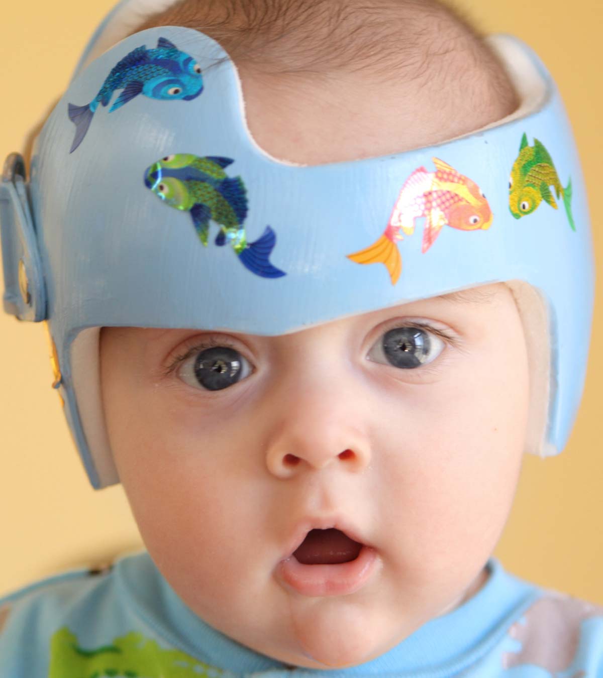 为什么婴儿要戴头盔?应该戴多长时间
