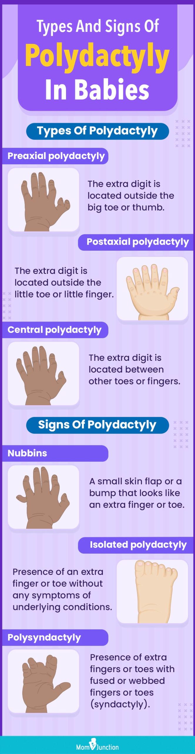 types and signs of polydactyly in babies (infographic)