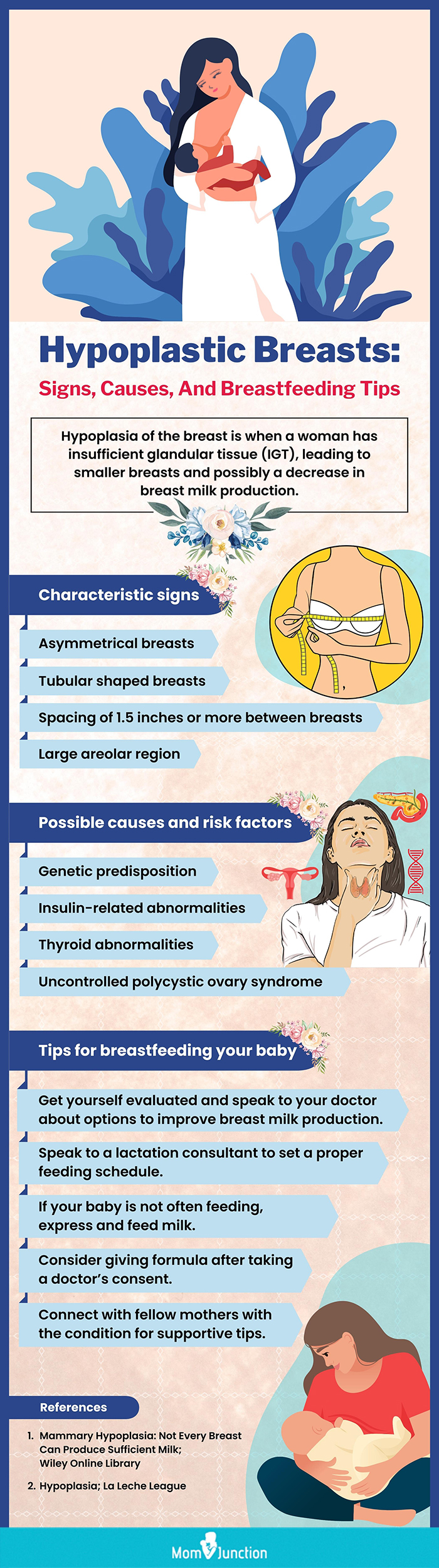 乳房发育不良的迹象、原因及母乳喂养提示(信息图)
