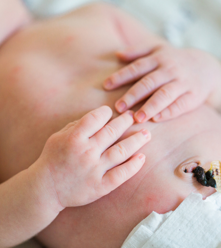 新生儿肚脐出血:什么是正常的，什么时候该担心