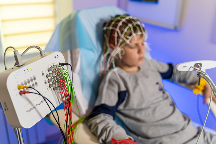 脑电图有助于诊断儿童肌阵挛
