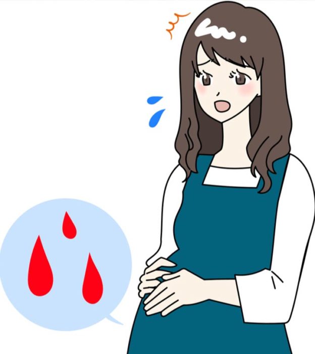 妊娠早期出血的9种原因及治疗