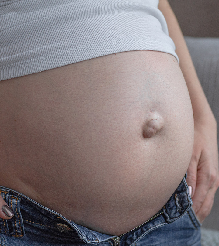 妊娠期脐疝的成因及治疗方法?