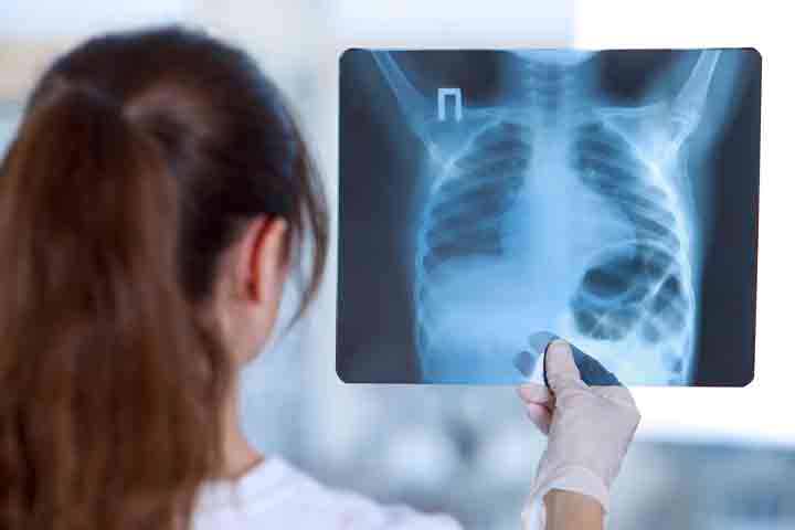胸部x光检查组织、器官和骨骼的感染迹象。